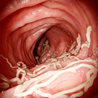 Eliminazione completa dei parassiti